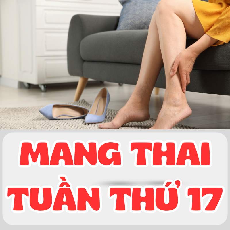 Mang thai tuần thứ 16 mẹ bầu bị giãn tỉnh mạch